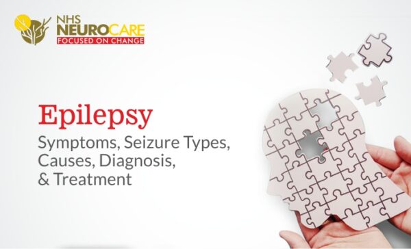 Epilepsy Symptoms, Causes, Diagnosis, & Treatment with the Best Neurologist