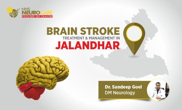 Brain Stroke treatment Dr Sandeep Goel Best Neurologist In Jalandhar, Punjab, India