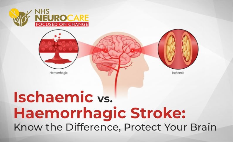 Strokes : Ischaemic vs. Haemorrhagic | Best Neuro Hospital |